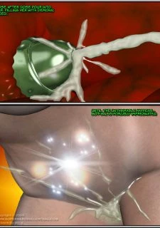 gg_164