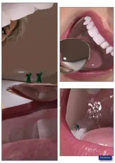 Micro Dentist (3)