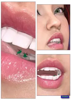 Micro Dentist (5)