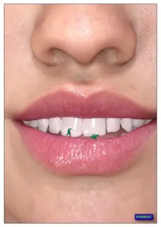 Micro Dentist (8)