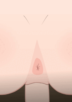 Tsunade Teaches Sakura A Hard Lesson 014